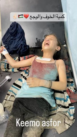 |كميه الوجع لطفله بتقطع القلب الله يرحمنا برحمتو 😞🇵🇸💔✌🏻
#اكسبلور #اكسبلور_فولو #اكسبلور_ضيفونا #غزّة...