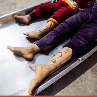 |💢 Parents in the #Gaza Strip write their children's names on their bodies so that they can be identified in case these small bodies become shreds.

40% of those who lost their lives as a result...