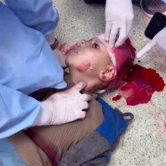 |اسرائيل تقتل الاطفال أثناء طعامهم الذين يحصلون عليه بصعوبة وقلة الإمكانيات الطبية تحيل دون إنقاذ الإصابات...