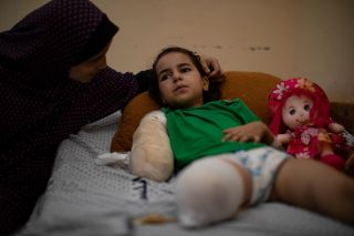 A Palestinian girl “9 years” from Al Jaal family lies in the hospital after lost her leg and her hand following Israeli air strike in #Gaza city 📸 EPA / Mohammed Saber ⁠ 
‎#غزة...
