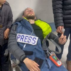|انا الحمد لله بافضل حال اصابتي بسيطة جدا كنت أتمنى أن تكون الشهادة ولكن شاء لله ان نكمل المسيرة ونكمل المشوار...