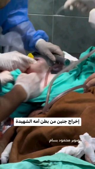 |جنين في بطن امه الشه يدة 😭💔

#gaza #تصوير 
#غزة #فيديو #صحافة #الجزيرة 
#غزة_تحت_القصف 
#cinema #cubcat #reels 
#reflexiones...