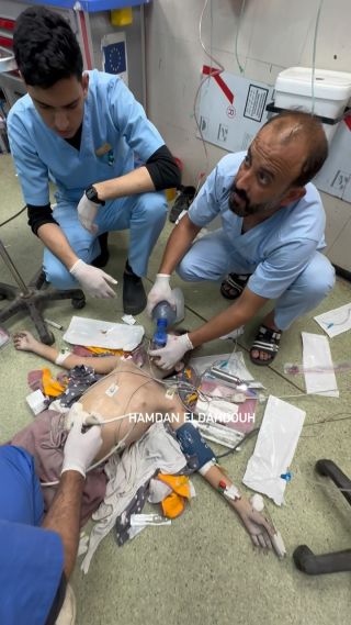 |Scenes from Nasser Medical Hospital in central Khan Yunis, and the sound of the groaning of children who are the primary target of the occupation in the war on Gaza.

مشاهد من مستشفى...
