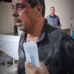 |🎥 "بدي أشوف ولادي" 
أب جريح يبحث عن أطفاله بين الإصابات القادمة إلى المستشفى عقب قصف الاحتلال لمنزلهم في...