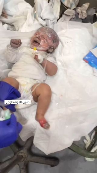 |An infant suffered burns as a result of the ongoing occupation bombing of civilian homes in the Gaza Strip.💔!
طفل رضيع أصيب بحروق جراء قصف الاحتلال المتواصل...