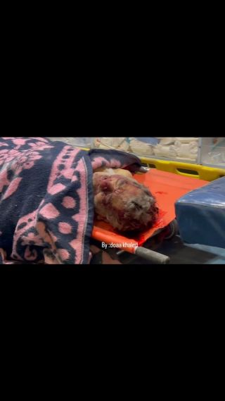 |أحد الشهداء  الذي  وصل إلى مجمع ناصر الطبي اليوم 💔
#gaza_today🇵🇸 #gaza_city #free_palestine🇵🇸 #غزة💔🇵🇸 #غزه_تحت_القصف💔...