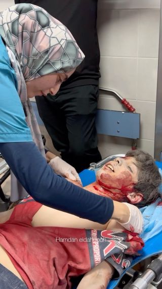 |Casualties arrived at Al-Shifa Hospital after an Israeli bombing of their house اصابات وصلت مستشفى الشفاء في قصف علي منطقة الكنز #غزة_تحت_القصف...