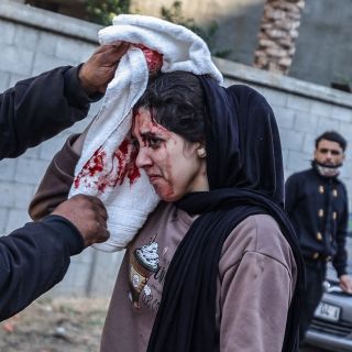 A Palestinian woman injured as a result of Israeli attack puts pressure on her head with a towel in Deir al-Balah, Gaza on January 05, 2024. Israel’s air, land and sea attacks continue on the Gaza...