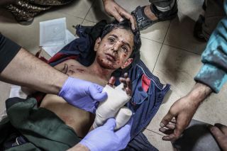 Injured Palestinian kid receives medical treatment at Aksa Hospital in Deir al Balah after Israeli attack on Al-Maghazi refugee camp, in Gaza Strip . Casualties and injuries reported after the...