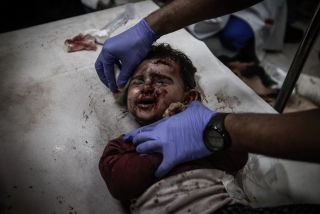 A Palestinian child wounded in the Israeli bombardment of the Gaza Strip is treated in Khan Younis on Friday, Dec. 8, 2023.
Photo by Mohammed Dahman
طفل فلسطيني أصيب في القصف...