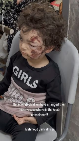 |Here, Arab children have changed their features, so where is the Arab conscience!!
هنا اطفال العرب تغيرت ملامحهم فأين الضمير العربي !! 💔😓
#غزة...