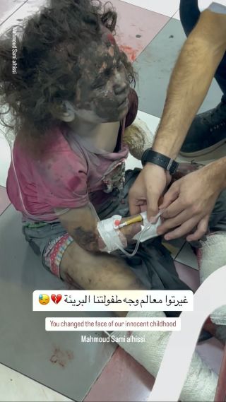 |You changed the face of our innocent childhood🥺🥺💔

#غزة #اطفال #اطفالنا #اطفالنا_مستقبلنا #اطفالنا_مسؤوليتنا #غزة_لحظة_بلحظة...