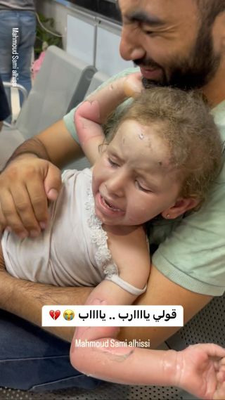 |ياااعالم صاروا يحرقوا الجلد حرق بقنا١بلهم 💔😓

#اطفال #اطفالنا #اطفالنا_مستقبلنا #اطفالنا_مسؤوليتنا...