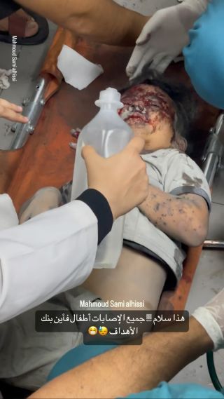|قولوا #حسبنا_الله_ونعم_الوكيل 😓😓💔

#اطفال #اطفالنا_مستقبلنا #اطفالنا_مسؤوليتنا|