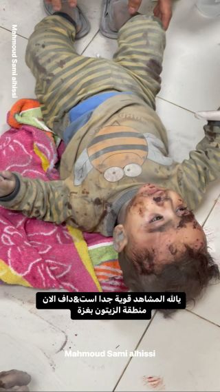 |است&داف منطقة الزيتون بغزة ووصول عشرات الإصابات الى مستشفى الشفاء الطبي بغزة 💔💔😓

#اطفال #أطفالنا #غزة...