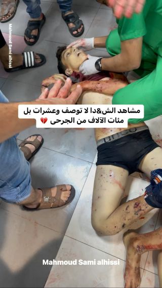 |مشاهد الشه،دا والعشرات من الاصابات الان ولله ما في ضمير حي وين الأمة ##غزة #شهدا #غزة #غزة_تنزف #غزة_أم_الضحايا|