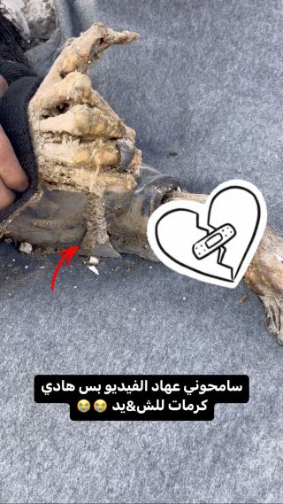 |لقيناه تحت الركام من شي اسبوعين 😭💔

#شهدا #غزة #غزة_الآن #غزة_فلسطين...