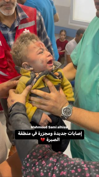 |إصابات جديدة وجميعهم أطفال 💔💔

#غزة  #اطفال #اطفالنا|