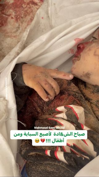 |ما أحلاه من صباح عصافير تترفع أصبع السبابة 😭💔

#اطفال #اطفالنا #اطفالنا_مستقبلنا|