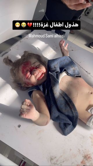 |أطفال غزة صباحا وبكل صباح ومساء 💔🤷🏼‍♂️

#غزة #غزة_تحت_القصف #غزة_تقصف #اطفال #اطفالنا #أطفالي|