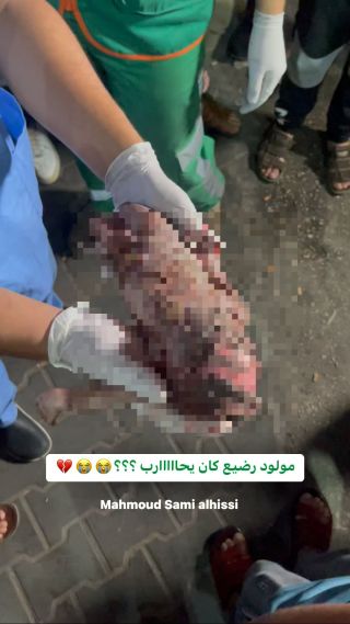 |ولكم حسووووووووو فينااا كرمال الله 😭😭💔

#غزة #غزة_تحت_القصف #غزة_اليوم #اطفال #مولود #مولود_جديد|