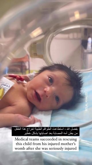 الطواقم الطبية في قطاع غزة تتمكن من إنقاذ مولود بعد إصابة أمه بجراح خطيرة.
Medical teams in the Gaza Strip were able to save a newborn...