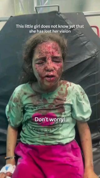طفلة لاتعلم انها فقد بصرها نتيجة قصف الاحتلا...ل 😞💔💔

This little girl does not know yet that she has lost her vision by Israeli bombardment in Gaza....