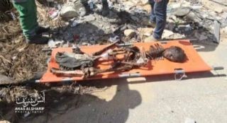 A decomposing body inside Al-Shifa Medical Complex, killed by the occupation army 

جثة متحللة داخل مجمع الشفاء الطبي قتلت على يد جيش الإحتلال

#CapCut...