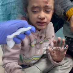 "كنا قاعدين بنلعب قصفو البيت علينا"
شاهد برائة الطفلة.💔

.
.
.
.
#photooftheday #reels #fyp #video 
@7eskander_el_kafarna