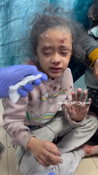 "كنا قاعدين بنلعب قصفو البيت علينا"
شاهد برائة الطفلة.💔

.
.
.
.
#photooftheday #reels #fyp #video 
@7eskander_el_kafarna