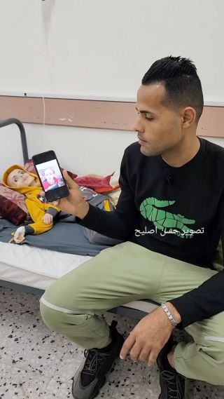شاهد الطفل يزن الكفارنة من بيت حانون نازح الى مدينة رفح ..تفاقمت حالته الصحية في الحرب بسبب نقص الغذاء...