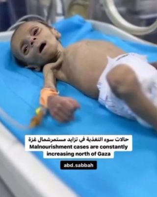 Children in northern Gaza are dying of hunger 

الأطفال في شمال غزة يموتون جوعا

#CapCut #Velocity #غزة_العزة🇵🇸 #تصوير #viralvideo #photography #photo...