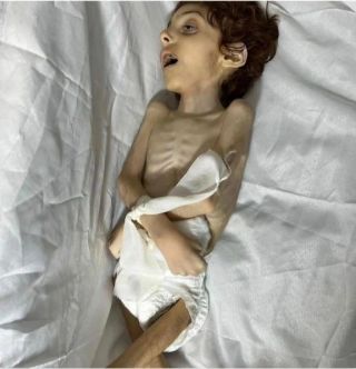 Our children are dying from lack of food, treatment and care. #Save_Gaza 
 

اطفالنا يموتون من قلة الغذاء والعلاج والرعاية 
#انقذو_غزة 

#CapCut...