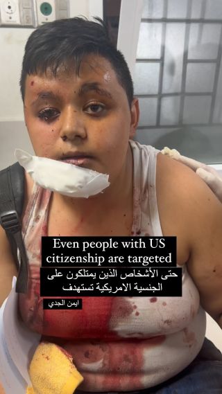 Even people with US citizenship are targeted 
#by #me @aymanalgedi12 

حتى الأشخاص الذين يحملون الجنسية الأمريكية مستهدفون