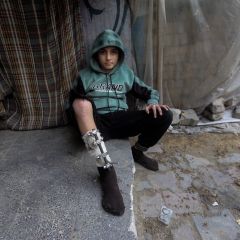 |The injured child youssef al-najar, that lost his 13 years old brother and whose house was bombed by the occupation.
💔💔

#فلسطين #غزة #الاردن #لبنان #سوريا...