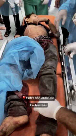|💔هكذا استشدت البراءة والطفولة

#غزة_تحت_القصف #غزة #فلسطين #لبنان #سوريا #مصر #الاردن #تونس #الجزائر #المغرب...