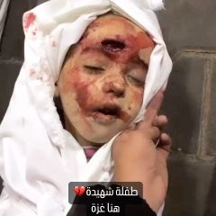 |طفلة شهيدة 💔

#غزة #فلسطين #gaza #لبنان #سوريا #الاردن #مصر #تونس #الجزائر #اسعوديه #قطر #اكسبلور_فولو #اكسسوارات...
