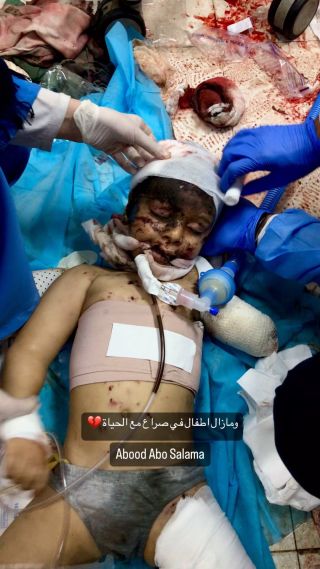 |ومازال اطفال في صراع مع الحياة💔

#gaza #غزة #غزة_تحت_القصف ##سوريا #لبنان #مصر #الاردن #الجزائر #السعودية #العراق...