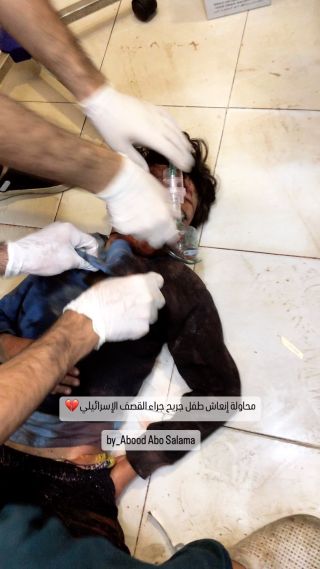 |محاولة إنعاش طفل جريح جراء القصف الإسرائيلي💔

Trying to resuscitate a child injured by the bombing💔

#gaza #غزة #فلسطين #غزة_الان...