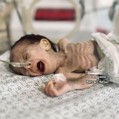 ♦️ Urgent - Pictures from the northern Gaza Strip show premature Palestinian babies slowly dying from the starvation siege practiced by the Israeli occupation forces as collective punishment...