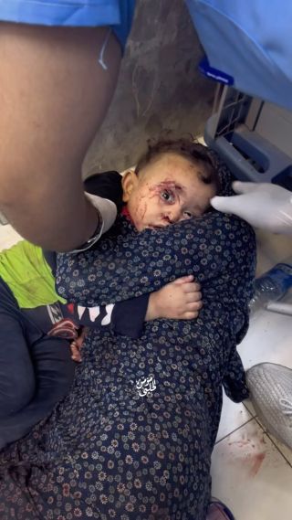 |هدف الاحـ.ـتلال #غزة 
ما ذنب هذا الطفل غير أنه فلسطيني من غزة 😞💔
مجزرة مستشفى المعمداني #غرة_تحت_القصف #gaza|