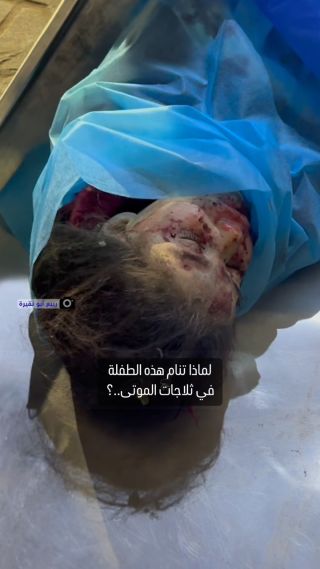 |لماذا تنام هذه الطفلة الفلسطينية في ثلاجات الموتى بدلا من نومها في فراشها آمنة مطمئنة؟.. فلسطيني يتساءل..! 🎥...