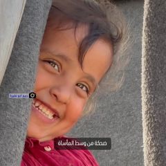 |طفلة فلسطينية تُظهر أسنانها الجميلة ضاحكة، رغم المعاناة والمأساة التي تعيشها مع عائلتها في أحد مخيمات...