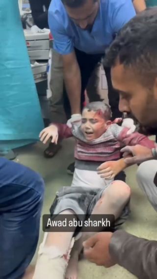 Children were injured after the Israeli occupation targeted Nasser Hospital

#gaz #gazaunderattack #palestine