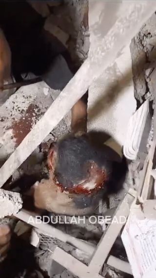 |هكذا استقبل أطفال #غزة عامهم الجديد 
انتشال طفل حي من تحت الأنقاض بعد قصف منزلهم فوق رؤسهم 

This is how the children of #Gaza...