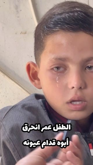 تخيل أبوك يستشه.د بالحرب ، لا وكمان تشوفه بنحرق وبولع وجلده بيسيح قدامك ! ..الطفل عمر انحرق أبوه قدام عيونه...