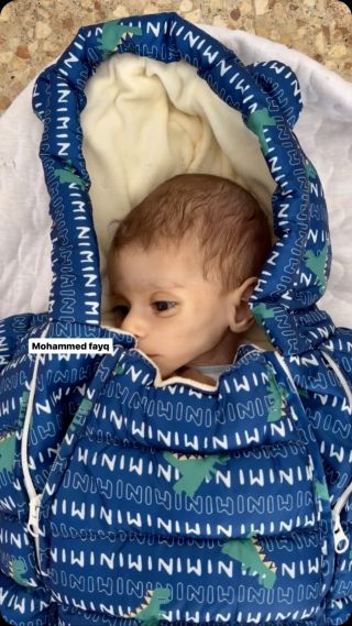 The child Fayez Abu Aita passed away at Al-Aqsa Hospital due to malnutrition and lack of available treatment amidst the closure of the Rafah crossing by the Israeli occupation...