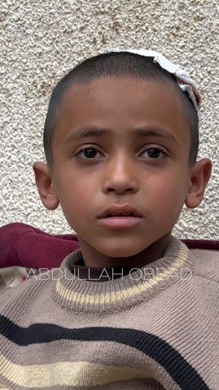 |كريم سعد.. طفل أُصيب في راسه وبقيت شظية عالقة بجسده حرمته من طفولته.. " كان عندي احلام والاصابة دمرتها كلها"...