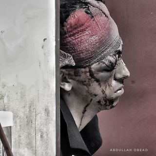 |مصاب جراء غارة اسرائيلية على #قطاع_غزة
#اكسبلور #غزة_تحت_القصف...
