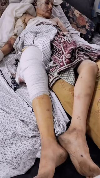 |أحمد.. ابن صديقي خالد الذي أعرفه منذ زمن 
نشرت فيديو قصير عنه أول ما أُصيب جراء قصف الاحتلال لمنزلهم في...